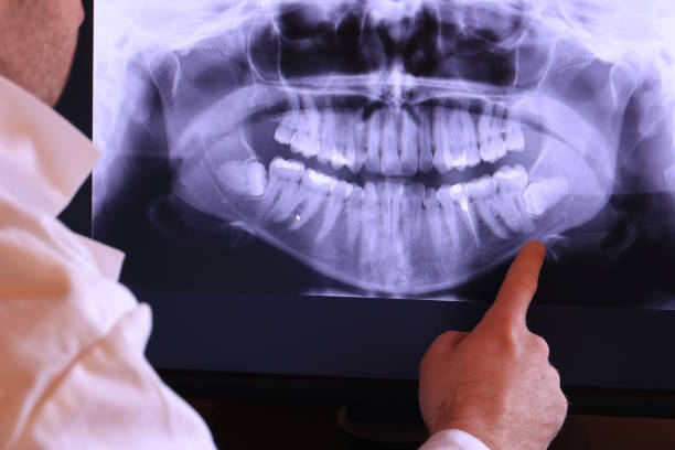 Best Urgent Dental Care for Toothache in South Dos Palos, CA